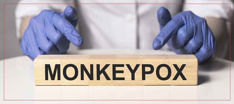 Monkeypox: What to Know in Sarasota, FL Monkeypox: What to Know in Sarasota, FL