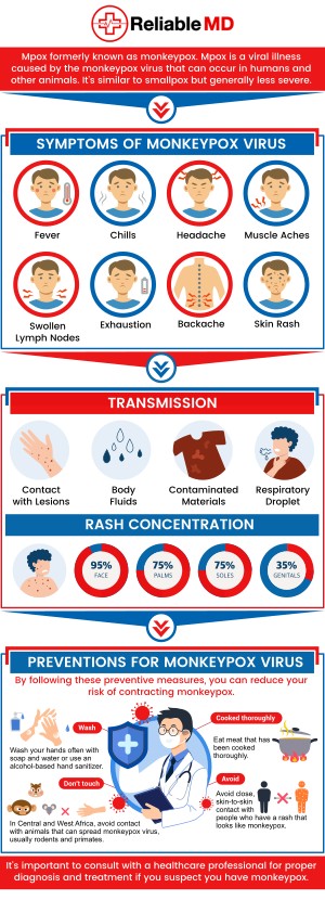 Monkeypox is a viral disease from the same family as smallpox, though its symptoms usually aren't as serious. The early symptoms of monkeypox are flu-like and include fever, fatigue, headache, and enlarged lymph nodes. Reliable MD gathered complete information on everything that you should know about monkeypox, from its origins to the present symptoms and what you can do to protect yourself. For more information, contact us today or book an appointment online. We are conveniently located at 2801 Fruitville Rd Unit 140, Sarasota, FL 34237. Monkeypox is a viral disease from the same family as smallpox, though its symptoms usually aren't as serious. The early symptoms of monkeypox are flu-like and include fever, fatigue, headache, and enlarged lymph nodes. Reliable MD gathered complete information on everything that you should know about monkeypox, from its origins to the present symptoms and what you can do to protect yourself. For more information, contact us today or book an appointment online. We are conveniently located at 2801 Fruitville Rd Unit 140, Sarasota, FL 34237.